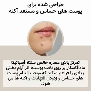 آمپول تسکین دهنده سنتلا ماداگاسکار اسکین 1004