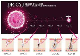 فیلر مو dr.cyj