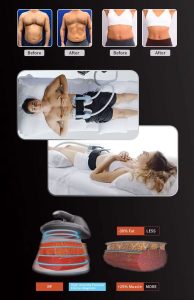 دستگاه لاغری و عضله‌سازی رومیزی ای ام اسکالپت