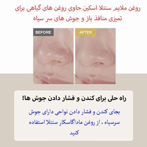 شوینده روغنی ملایم ماداگاسکار سنتلا اسکین 1004
