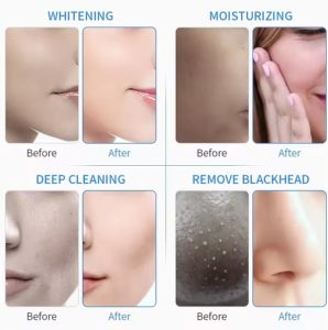 دستگاه هیدروفیشیال 6 کاره موتور سنگین